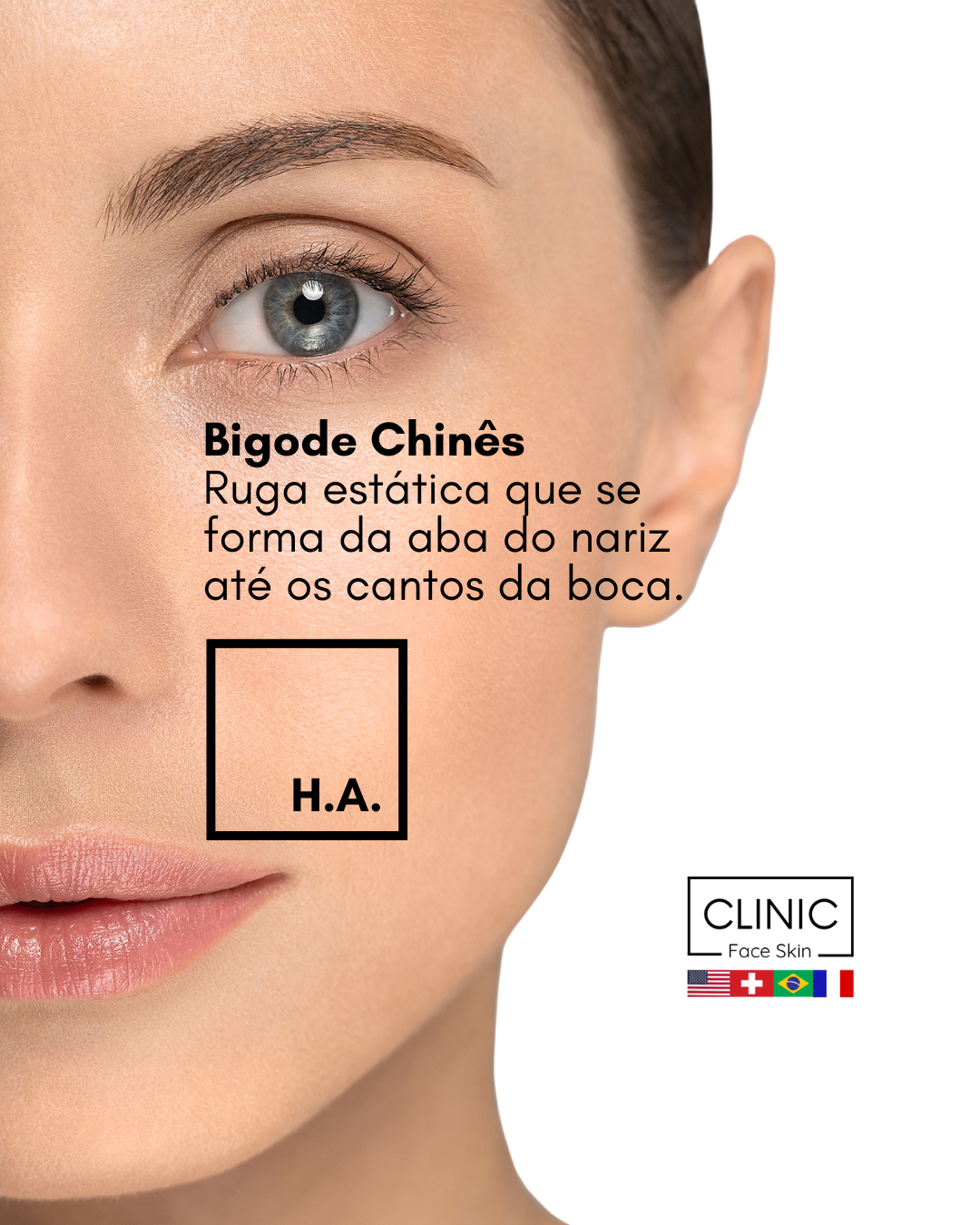 bigode chines