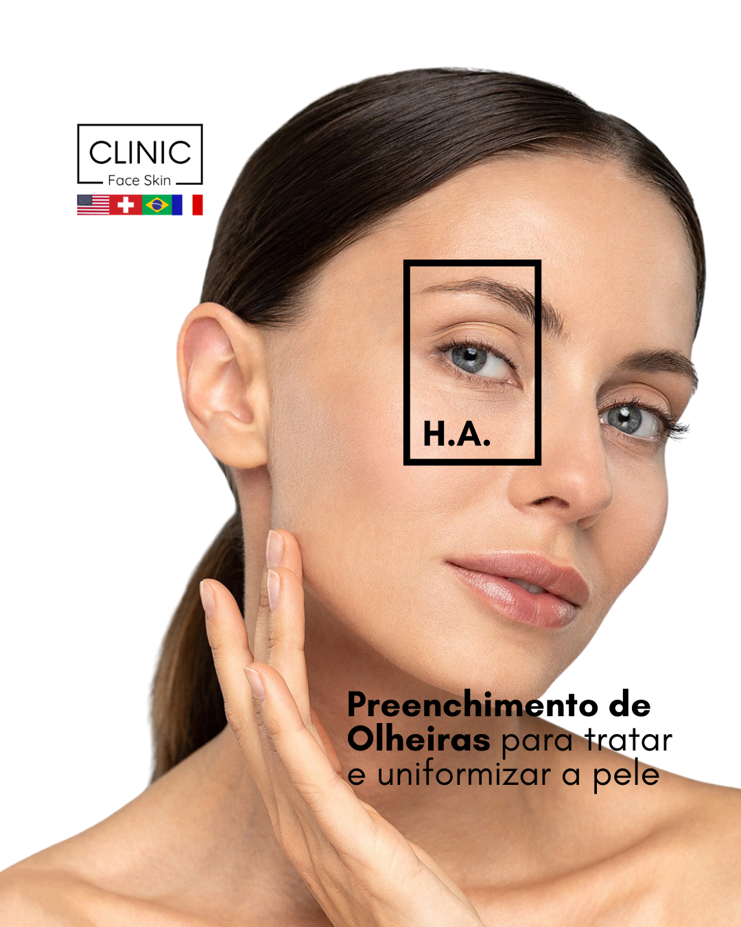 olheiras